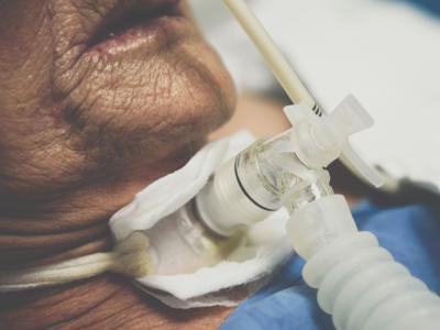 Patient with tracheostomy and ventilator