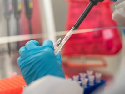 PCR testing in lab