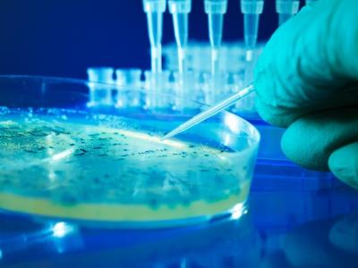Salmonella colonies in petrie dish