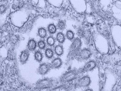 2009 H1N1 influenza virus