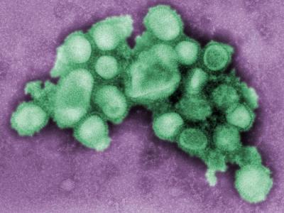 2009 H1N1 influenza virus