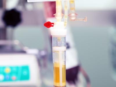 Plasma transfusion