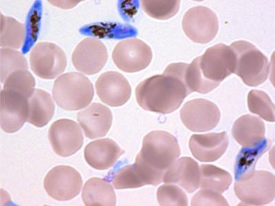 Plasmodium falciparum