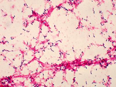 This is a photomicrograph of Streptococcus pneumoniae bacteria having been grown from a blood culture.