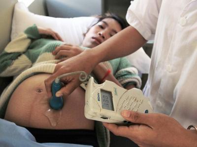 Pregnant woman getting an ultrasound