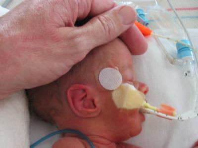 Premature baby