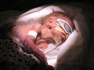 Premature infant