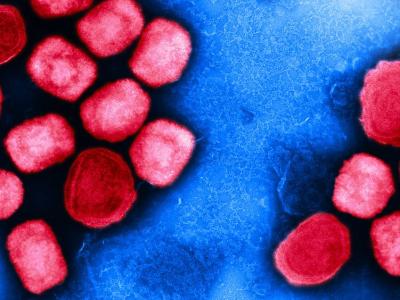 Monkeypox viruses as seen through a microscope