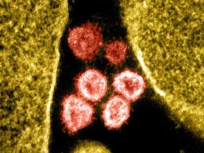 SARS-CoV-2 viruses