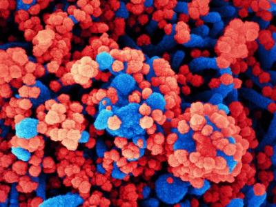 Red SARS-CoV-2 infecting blue cells