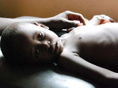 Rehydration therapy for diarrhea