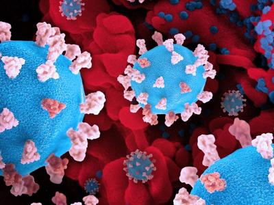 SARS-CoV-2 virus COVID-19