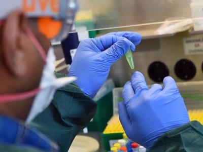 RT-PCR testing by lab worker