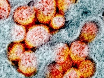 COVID-19 virus highly magnified