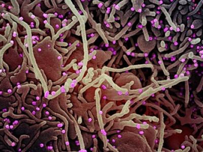 COVID-19 virus, highly magnified