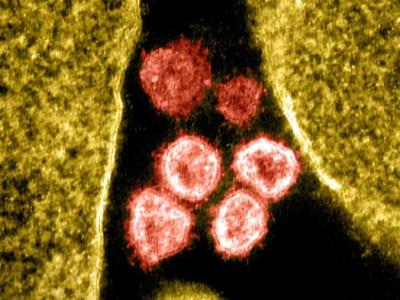 COVID-19 viruses under the microscope