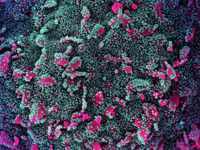 SARS-CoV-2 viruses magnified