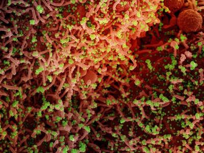SARS-CoV-2 highly magnified