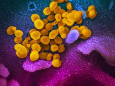 COVID-19 virus highly magnified