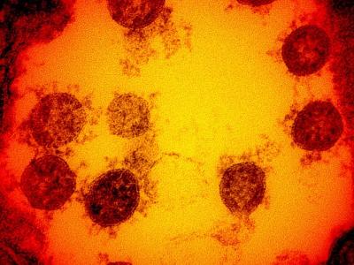 SARS-CoV-2, the virus that causes COVID-19