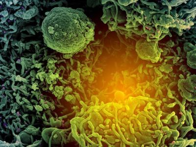 SARS-CoV-2 under the microscope