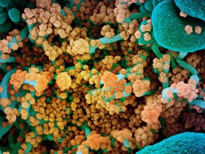 SARS-CoV-2 viruses, highly magnified