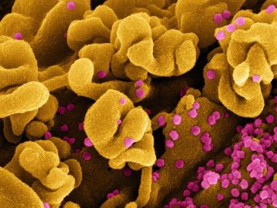 SARS-CoV-2 Omicron viruses infected a cell