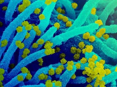 COVID-19 viruses on cell surface
