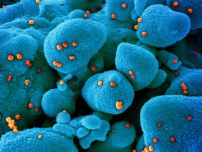 SARS-CoV-2 viruses magnified