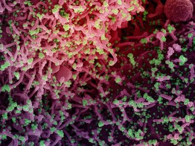 SARS-CoV-2 under the microscope