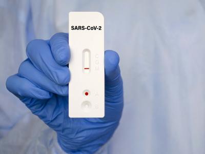 SARS-CoV-2 rapid test