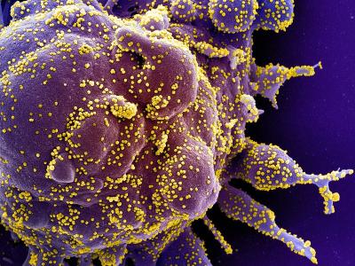 SARS-CoV-2 viruses, highly magnified