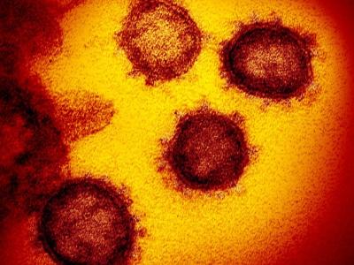 SARS-CoV-2 viruses highly magnified