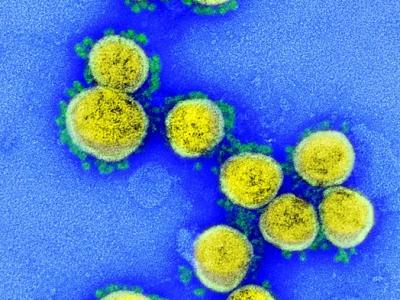 COVID-19 viruses