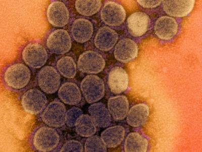 SARS-COV-2 viruses