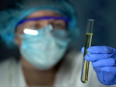 Scientist with urine in test tube