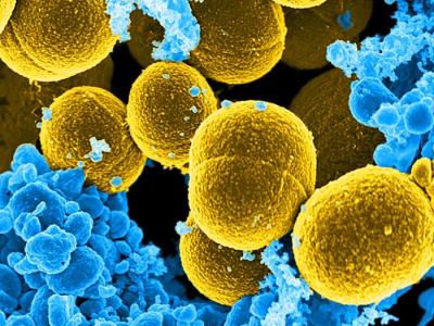 Staphylococcus aureus