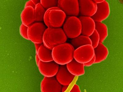 Staphylococcus aureus