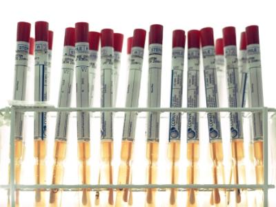 Swabs