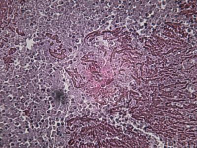 TB-infected lung tissue