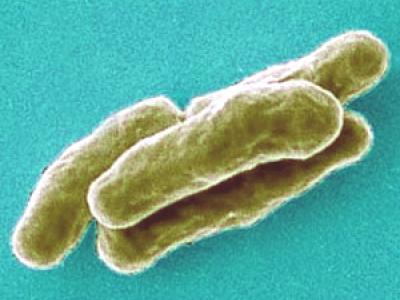 Mycobacterium tuberculosis highly magnified