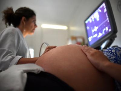 Ultrasound