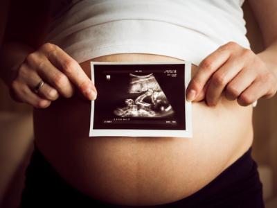 Ultrasound image on pregnant belly