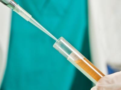 Urinalysis