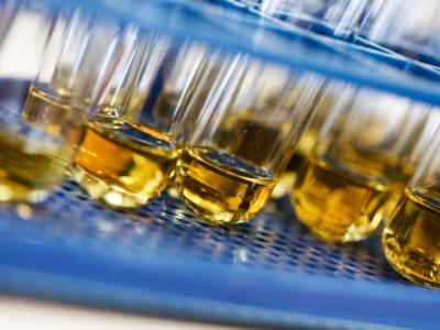 Urine test tubes