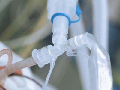 Ventilator equipment
