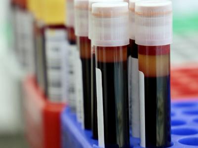 Vials of blood