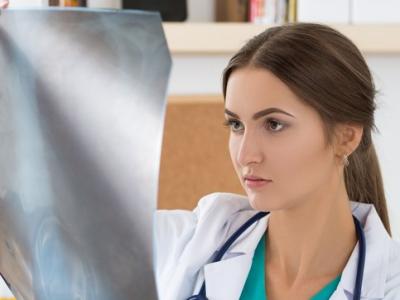 Young doctor examining x-ray