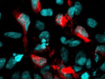 Zika-infected neural cells