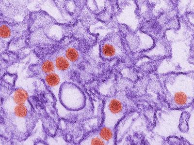 Zika via electron microscope